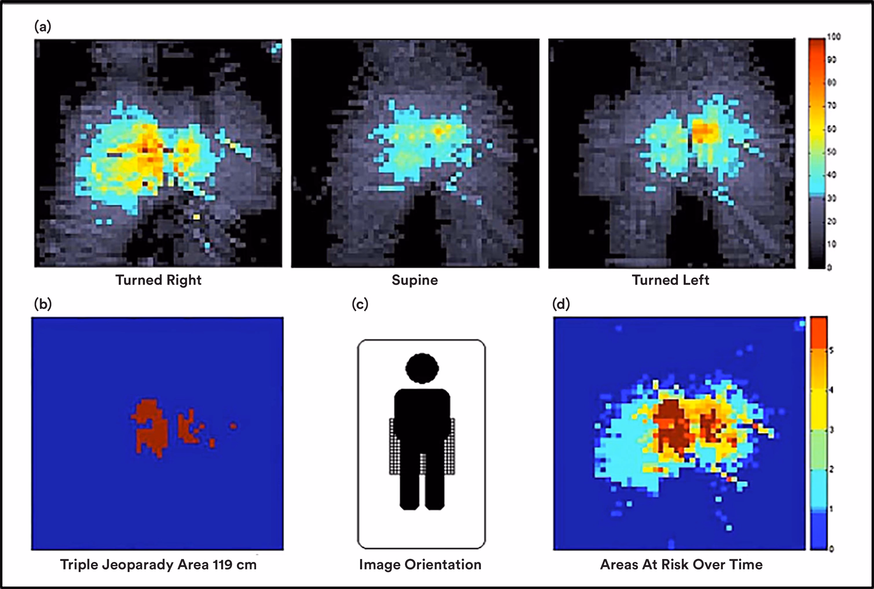 Pressure maps from the Peterson study